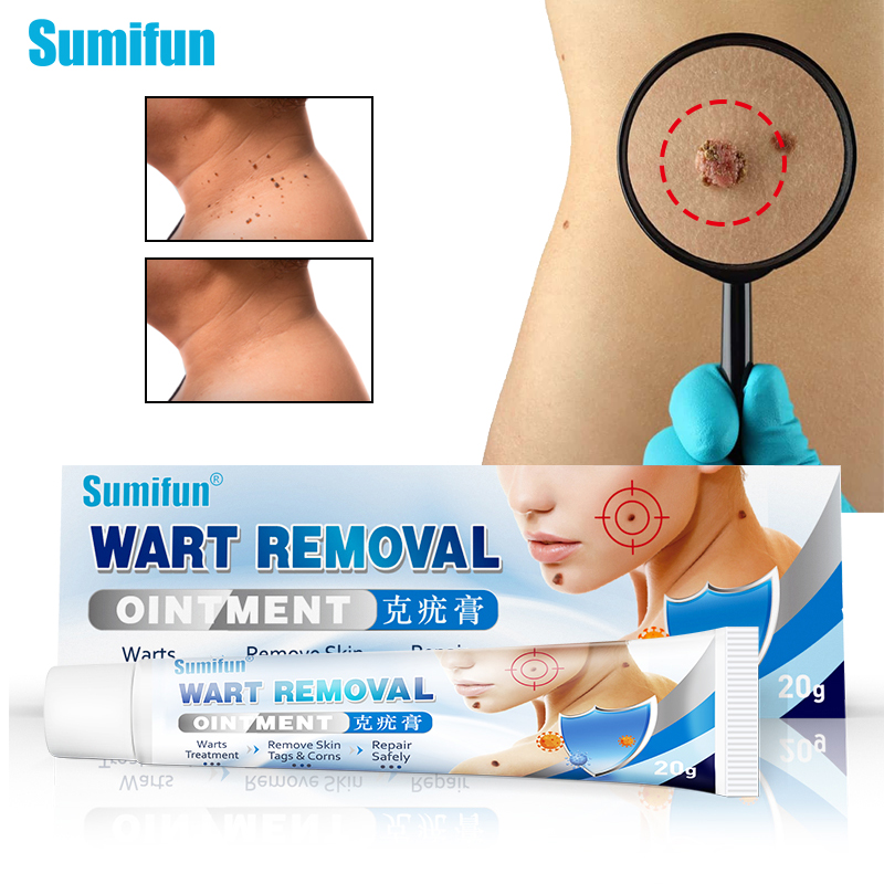 Sumifun Warts Remover Original Cream Wart Remover Ointment Wart