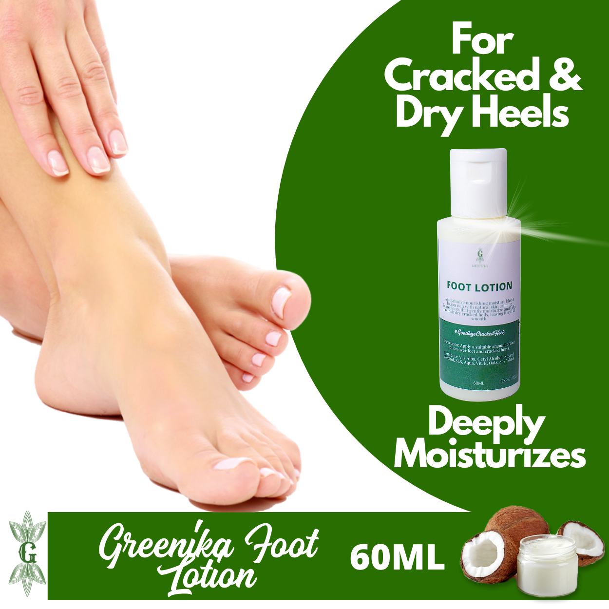 [ VITAMIN E FOOT CREAM LOTION ] Greenika Natural Foot Cream Lotion for Dry Cracked Hands