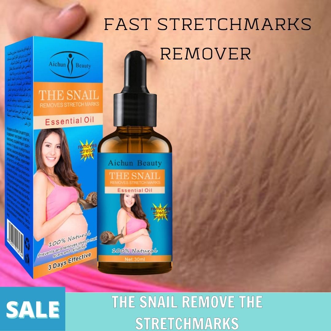 SUPER SALE!! Authentic Stretchmark Remover Essential Oil Pregnancy Scars Safe For Pregnant Women Pregnancy Scars Maternity Slackline Skin Repair Arms Thigh Hips Back Stretch Marks 30ML