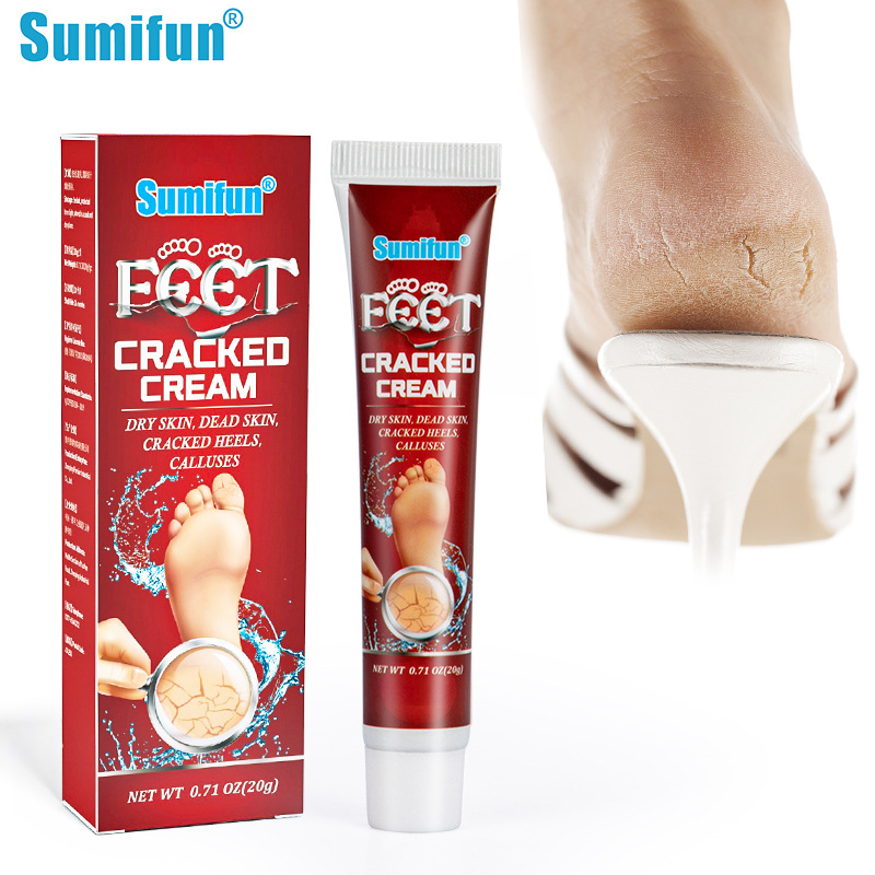 COD]Sumifun foot cream cracked heel remover hand cream for dry hands Foot  cream for Cracked heels callus removal for foot pair with callus remover  foot grinder callus cream remover Moisturizing Cracked Callus