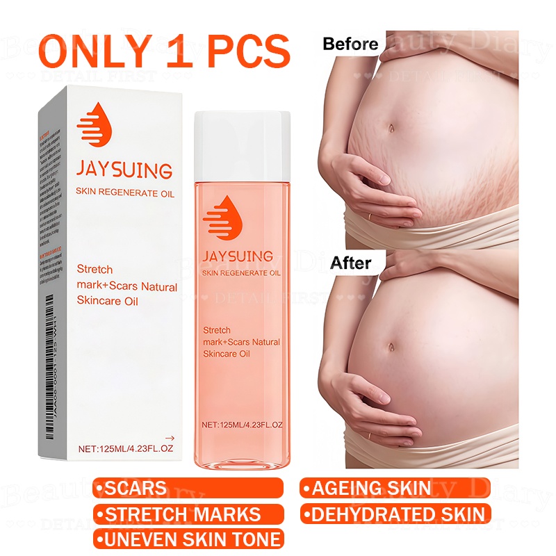 Body Oil – Repairs Scars And Stretch Marks Effectively Improves Uneven Skin Tone Natural Ingredients Suitable For Body And Pregnant Women. Skin Regeneration Oil 125ml