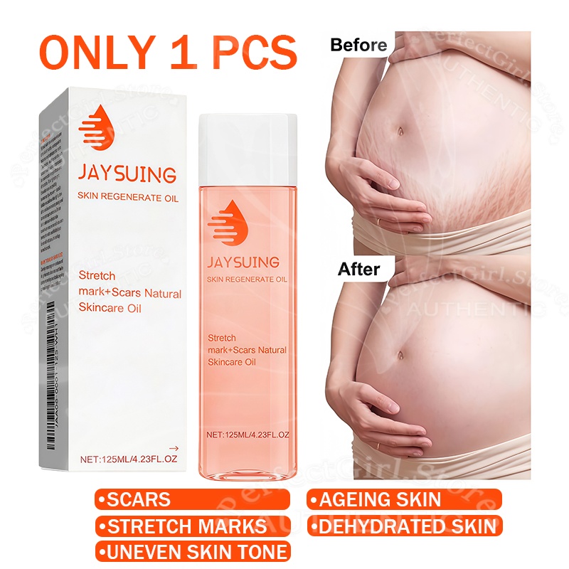 Skin Care Oil Intimate Area Soothing Oil，Locks In Moisture Enhances Skin Elasticity Fades Scars And Stretch Marks Effectively Improves Uneven Skin Tone.