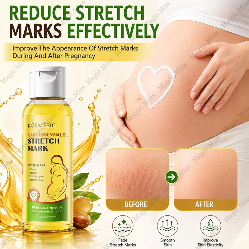 Stretch Mark Remover Essential Oil Original Intensive Skin Treatment Anti Strechmarks and Scars Cellulite Removal 100ml