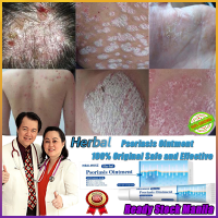 100% Original Authentic Natural Chinese Herb Herbal Medicine Psoriasis Eczema Ointment Dermatitis Vitiligo Skin Rash ointment for itchy skin and allergy Ointment
