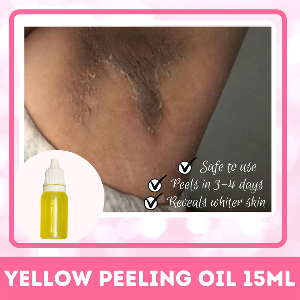 Underarm Peeling Oil 15 ml (Yellow Peeling Oil) by Clarity Essentials review and price